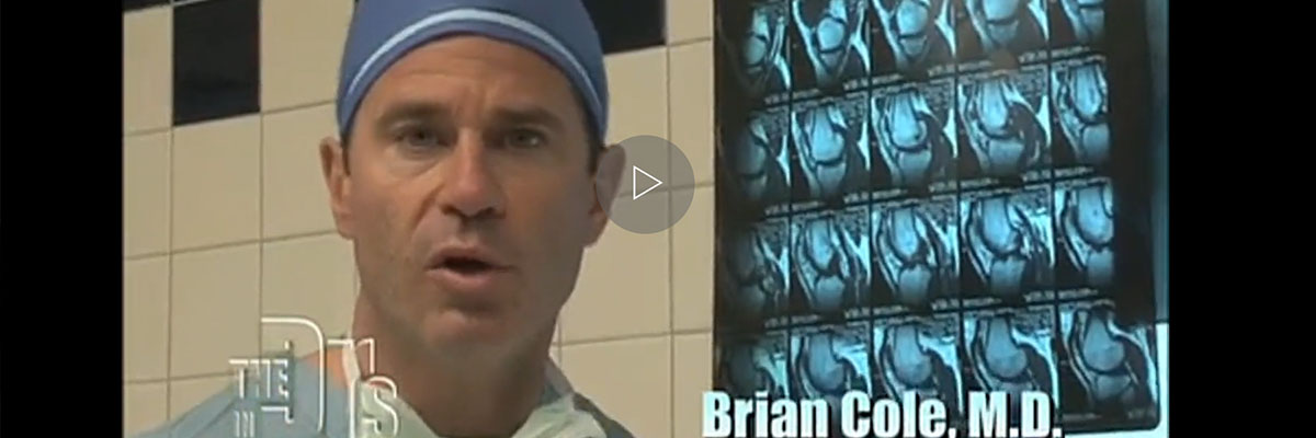 Knee Cartilage Transplant Video Performed by Orthopedic Surgeon Dr. Brian Cole