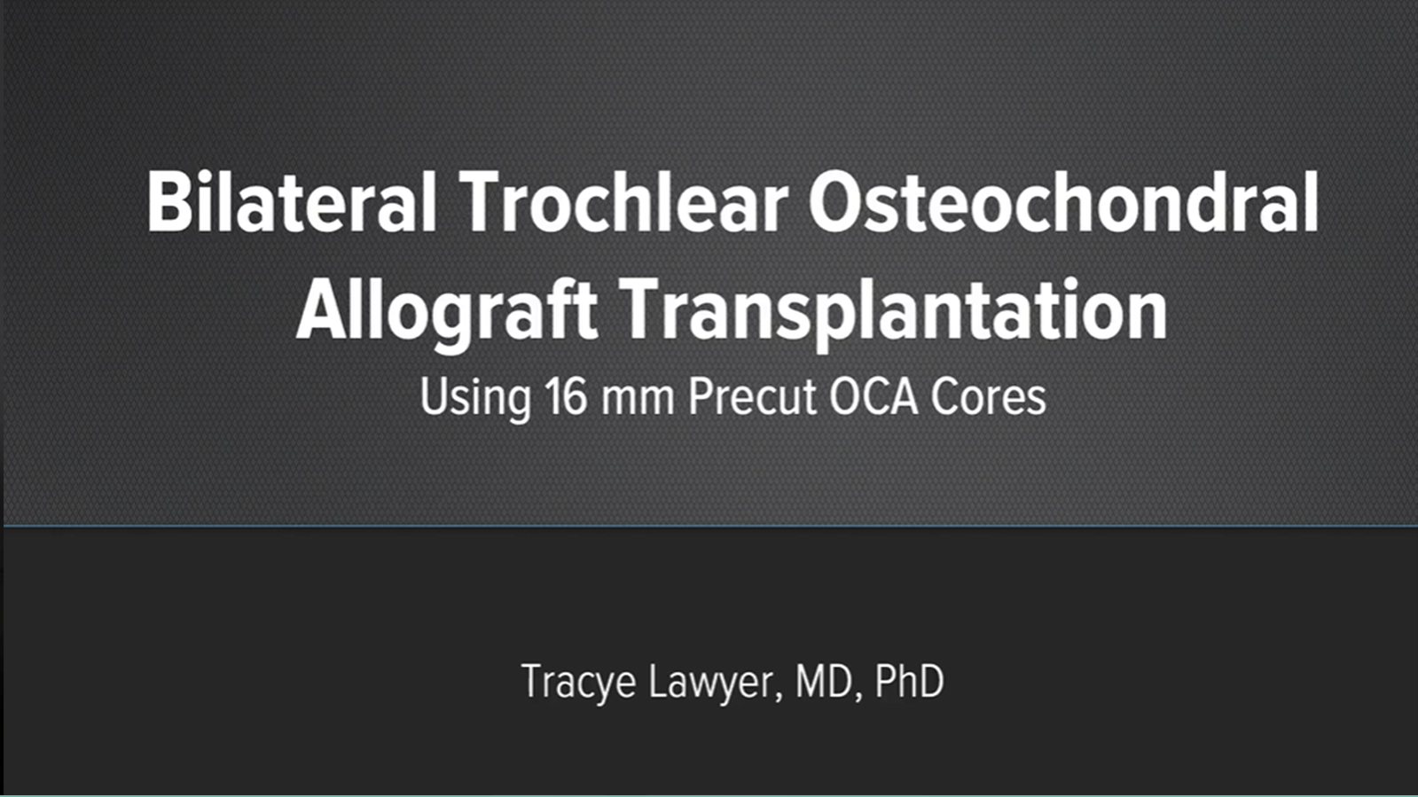 This is a a case in which a precut 16 mm osteochondral allograft core is used to treat a 54-year-old marathon runner with bilateral trochlear osteochondral defects. (External Link)