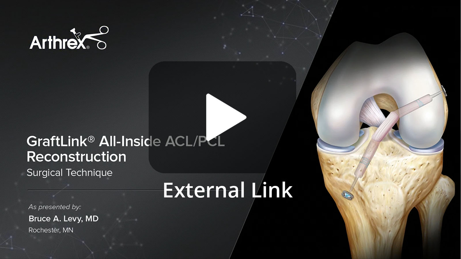 GraftLink® Tendon All-Inside ACL/PCL Reconstruction (External Link)