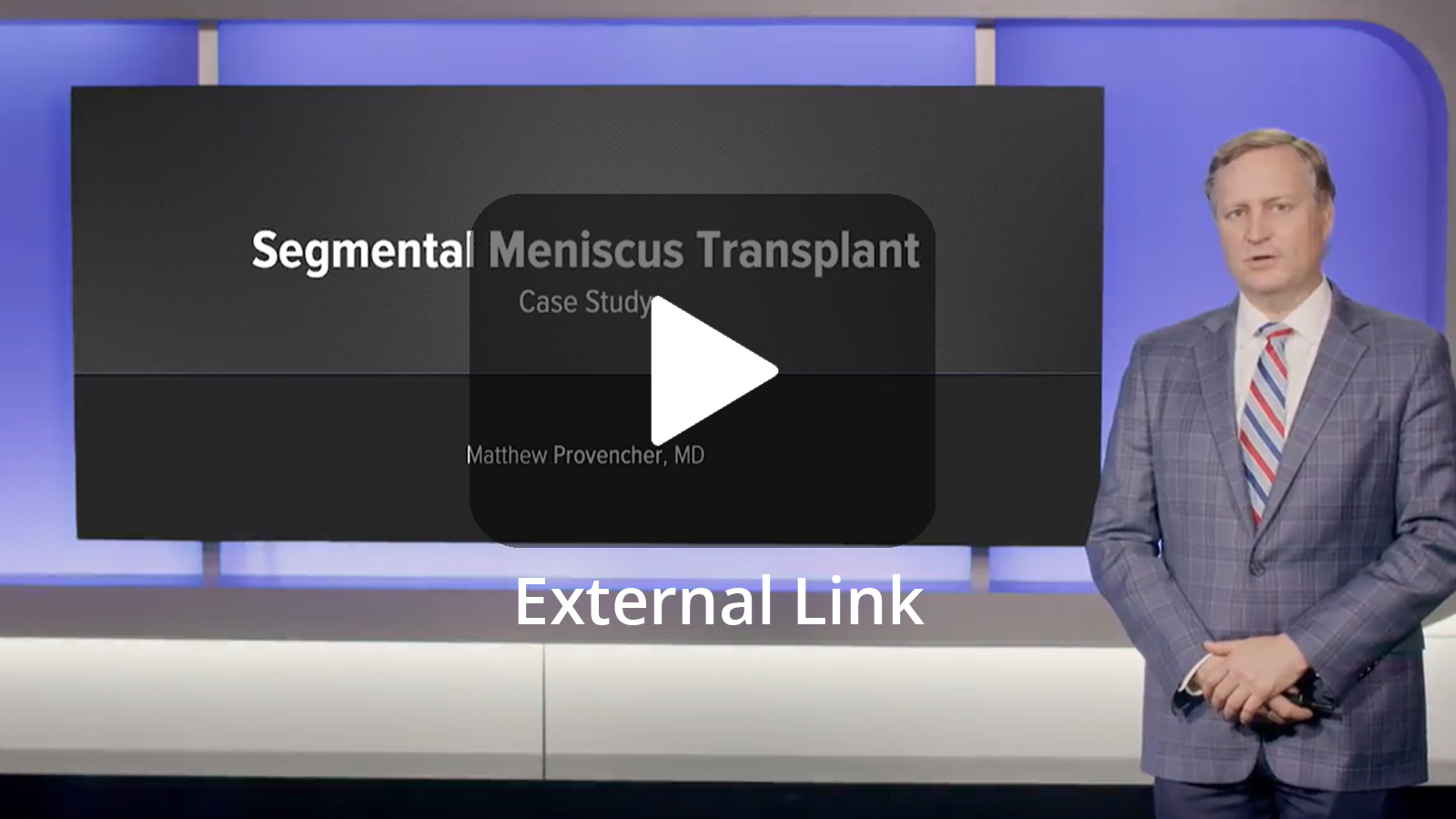 Case Study: Segmental Meniscus Allograft Transplantation for a Focal Meniscal Deficiency (External Link)