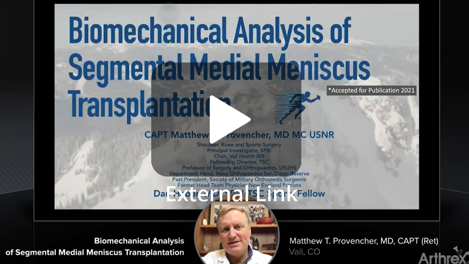 Segmental Meniscus Transplantation for Meniscal Repair and Replacement (External Link)