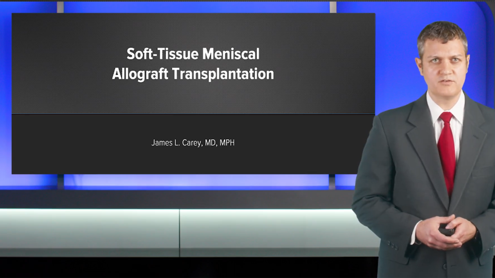 James L. Carey, MD, MPH. reviews scientific support and clinical successes of soft-tissue meniscal allograft transplantation (MAT). Dr. Carey addresses the technique’s various advantages and disadvantages, discusses his experience with the procedure, and shares several surgical pearls. (External Link)