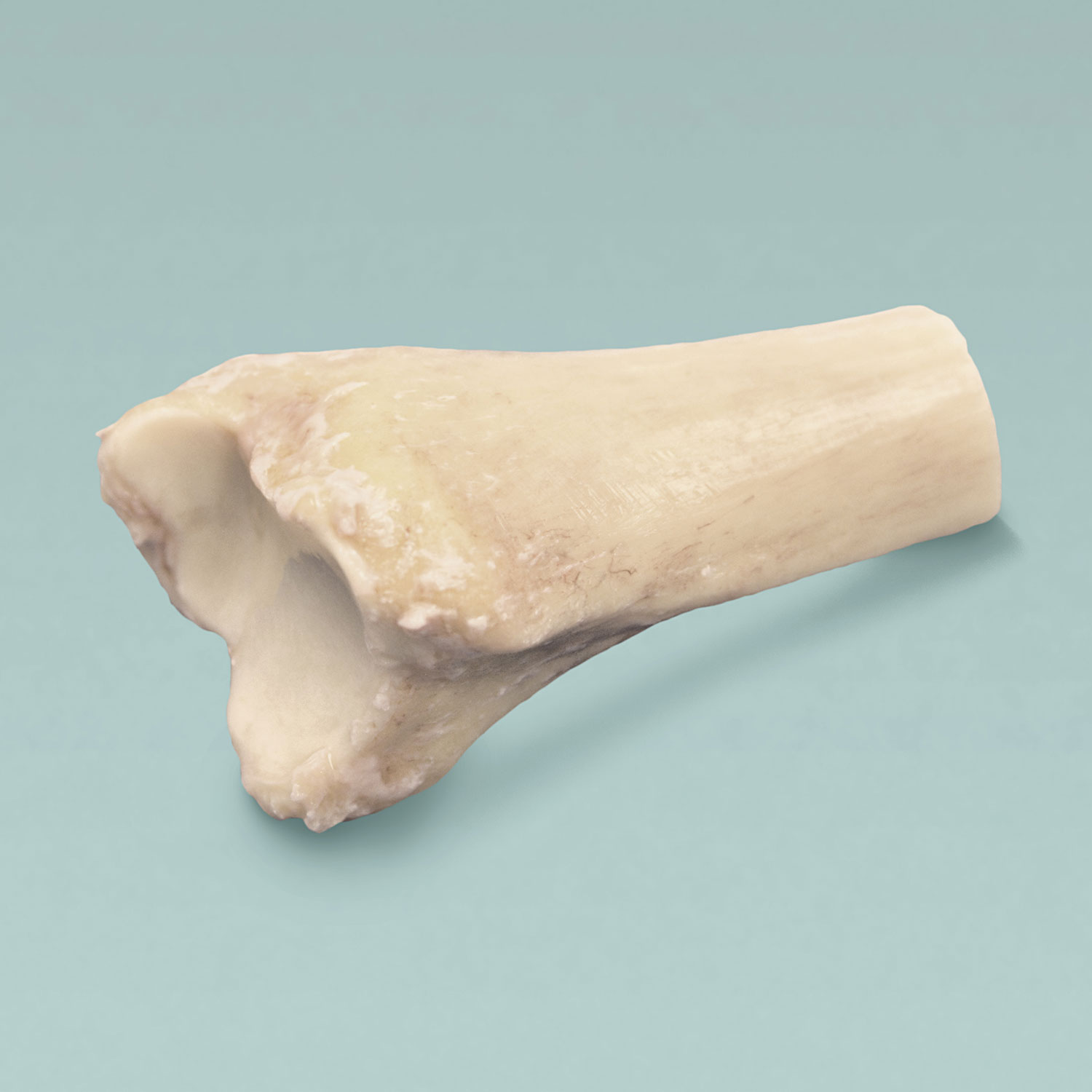 Distal Tibia